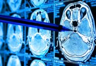 Artificial intelligence kunstmatige intelligentie zorg health brains hersenen